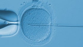 体外受精のイメージ