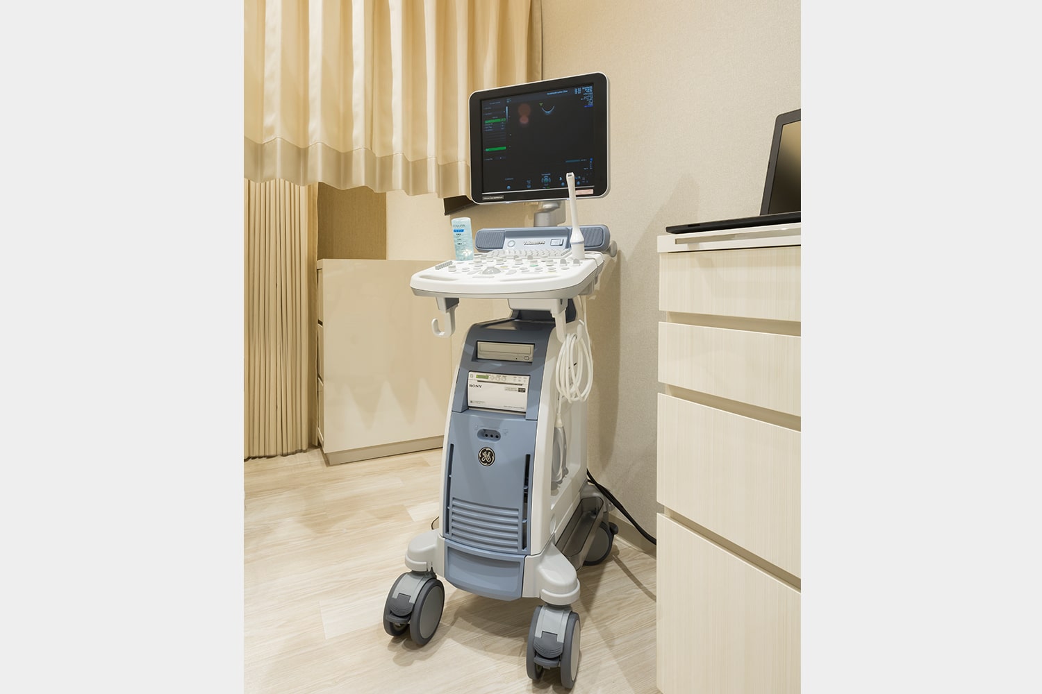 超音波診断装置