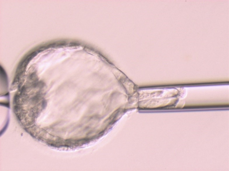 PGT-A（着床前胚染色体異数性検査）イメージ